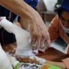 MENTARI Clubfoot, Harapan Baru Anak dengan Kaki Pengkor